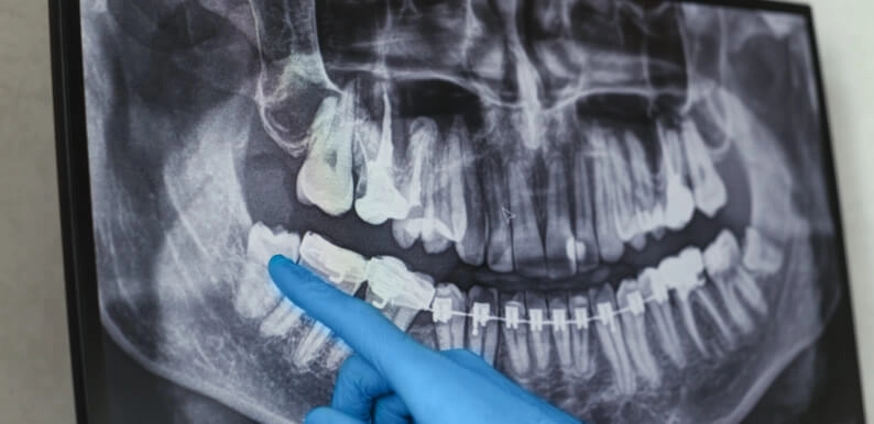 Dentiste analysant une radiographie de la bouche d'un patient