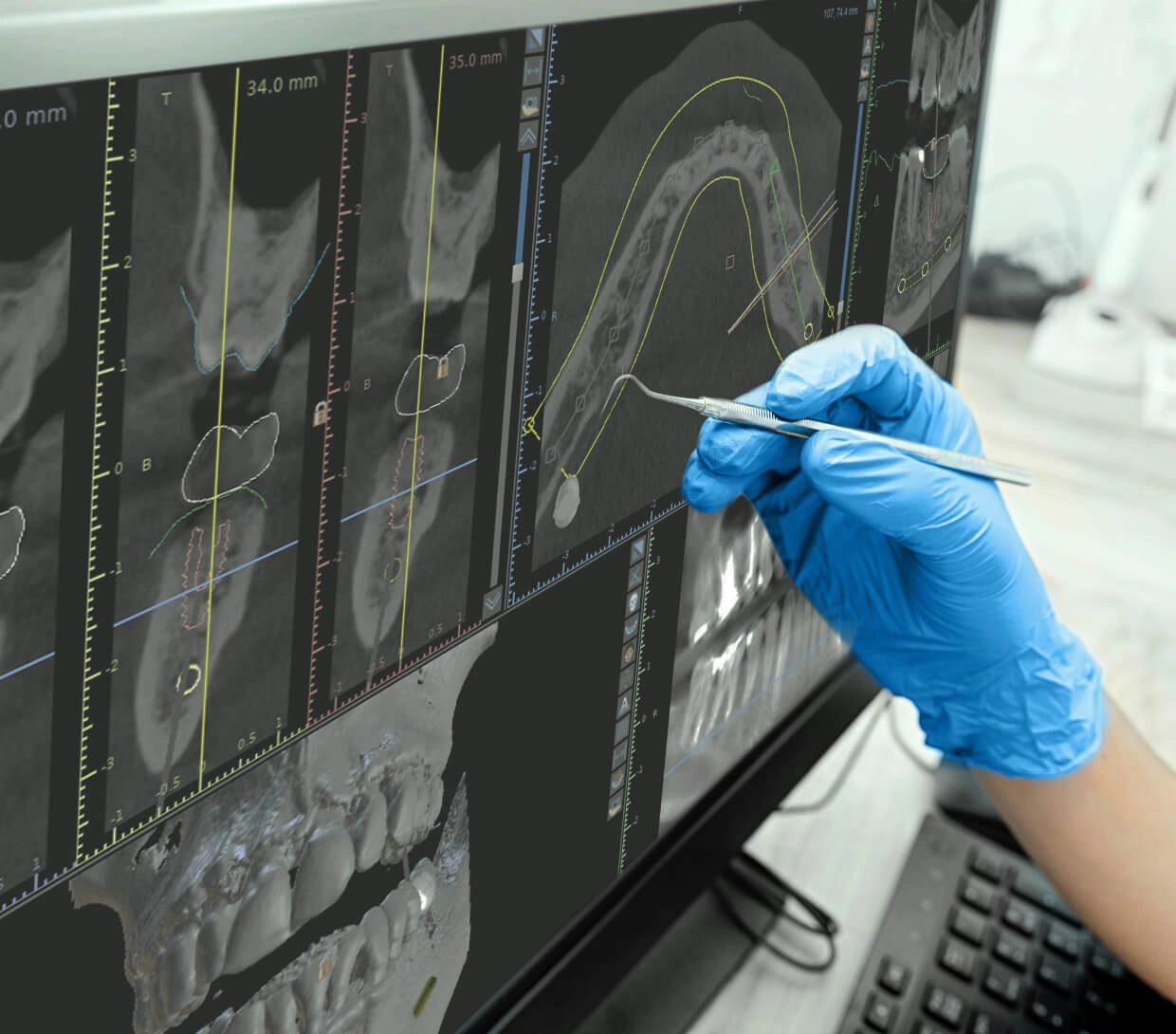 Dentiste analysant une radiographie panoramique des dents d'un patient