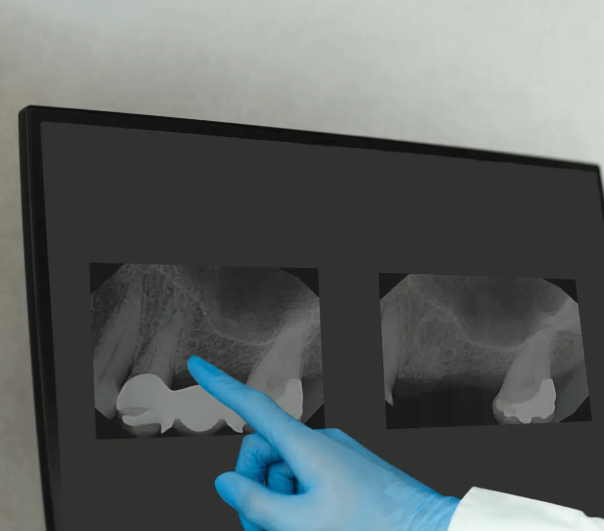 Dentiste analysant une radiographie d'un implant