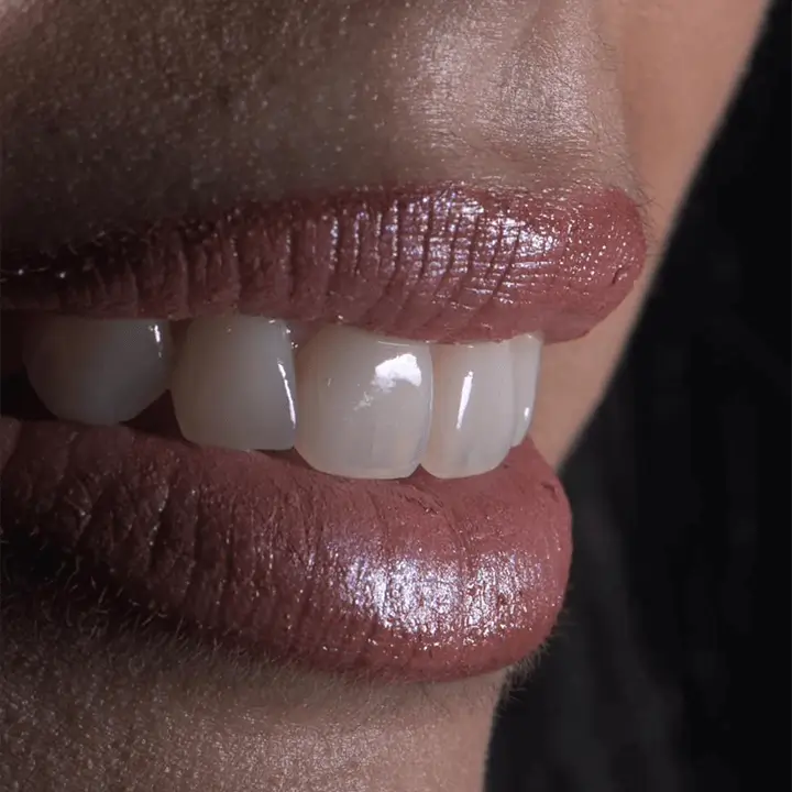 Photo de la bouche d'une femme souriante