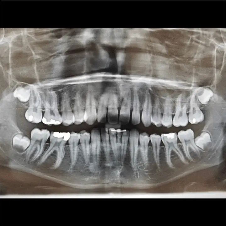 Radiographie de la bouche d'un patient
